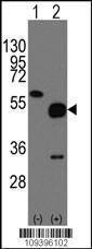 Anti-NPTX2 (C-term) Antibody