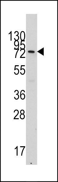 Anti-VE Cadherin (CDH5) (N-term) Antibody