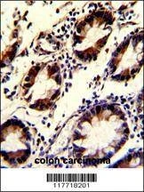 Anti-KLF4 Antibody