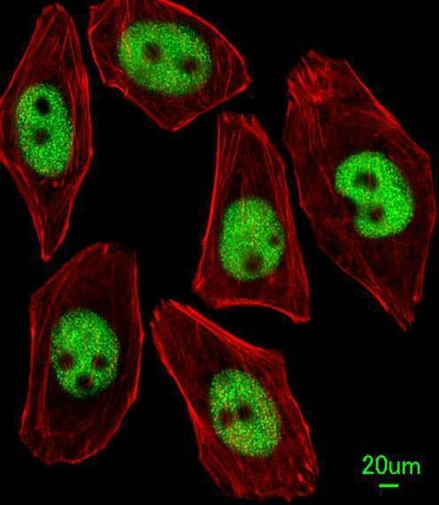Anti-KLF4 Antibody