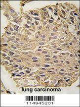 Anti-ALDOA (C-term) Antibody