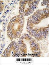 Anti-S adenosylhomocysteine hydrolase (ACHY) (C-term) Antibody