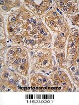 Anti-AKR1A1 (C-term) Antibody