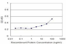 Anti-GAN Antibody