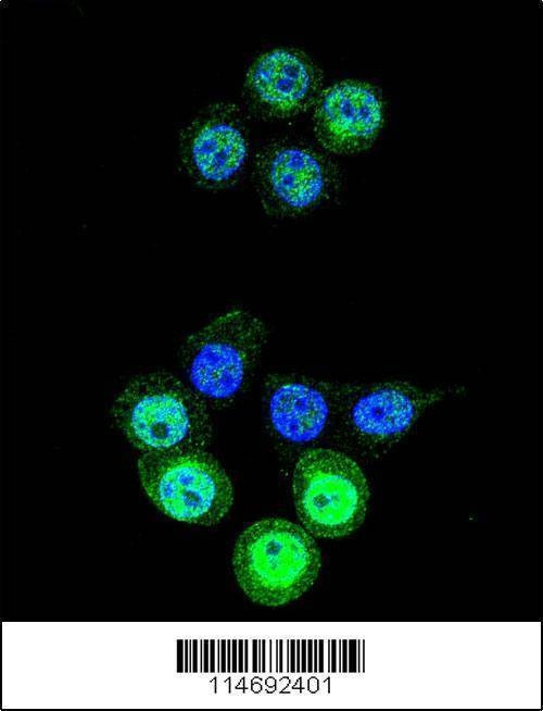 Anti-AKR1B1 (C-term) Antibody