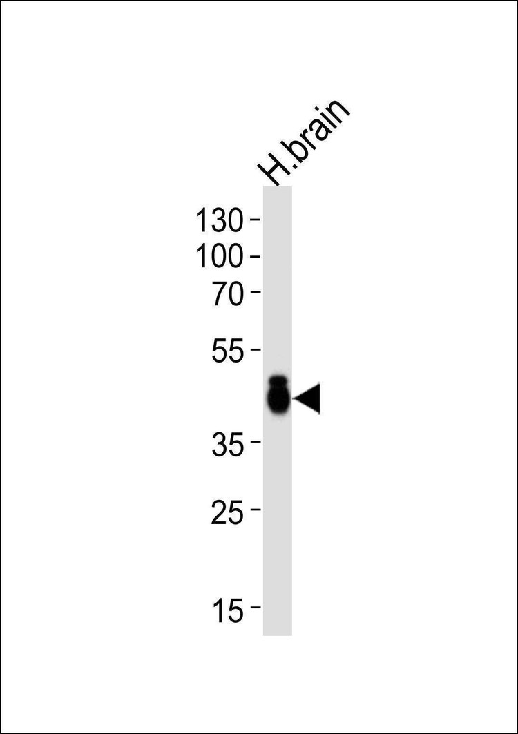 Anti-ALDOC (C-term) Antibody
