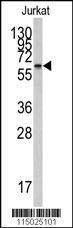 Anti-CYP26A1 (Center) Antibody