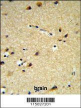 Anti-CYP26A1 (C-term) Antibody