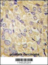 Anti-FZD1 (Center) Antibody