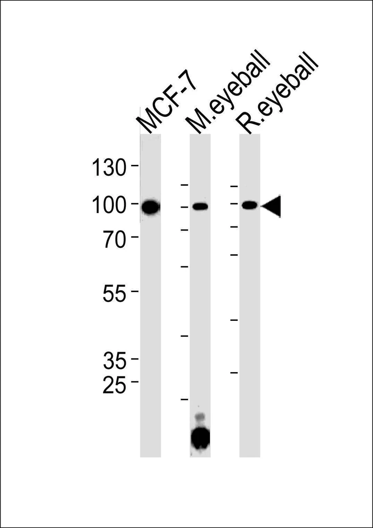 Anti-COL9A1 (Center) Antibody