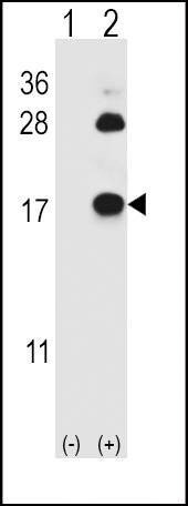 Anti-FABP4 (Y20) Antibody