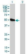 Anti-GART Antibody