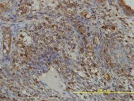 Anti-GART Antibody