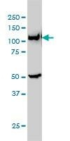 Anti-GART Antibody