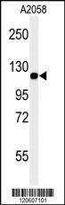Anti-MCAM (C-term) Antibody