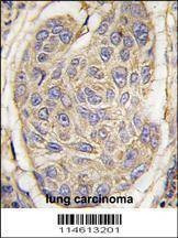 Anti-B2M (C-term) Antibody