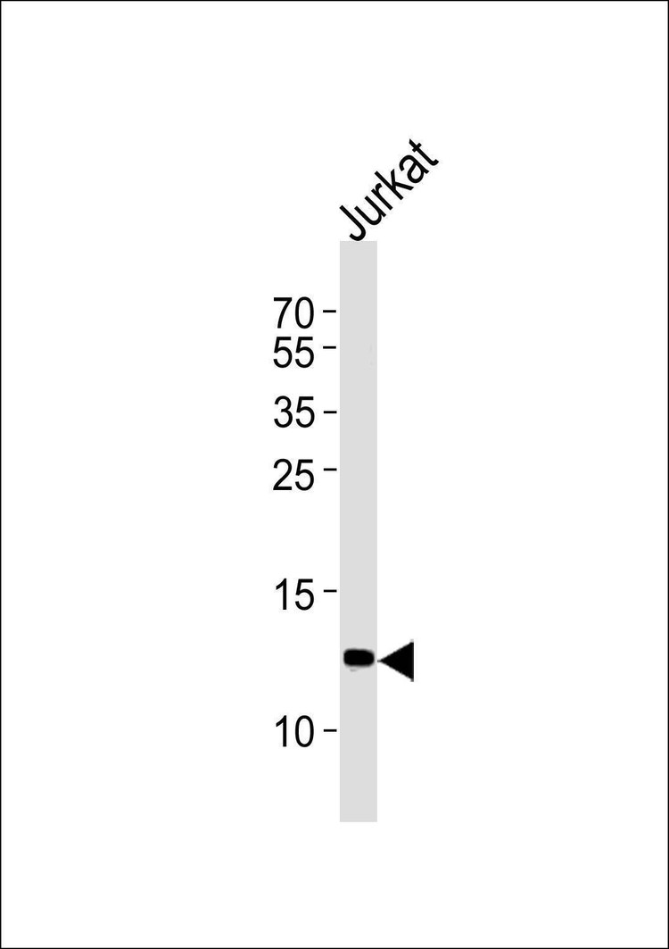 Anti-B2M (C-term) Antibody
