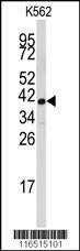 Anti-FBL (Center E120) Antibody