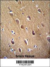 Anti-NSE (Y236) Antibody