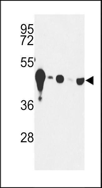 Anti-NSE (Y25) Antibody