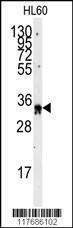 Anti-EXOSC8 (C-term) Antibody