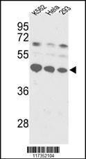 Anti-SSB (C-term) Antibody