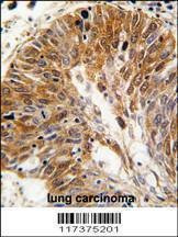 Anti-PSMD11 (C-term) Antibody