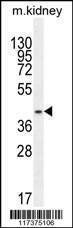 Anti-PSMD11 (C-term) Antibody