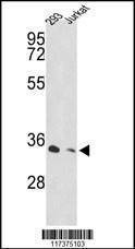Anti-PSMD11 (C-term) Antibody