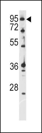 Anti-ATXN1 (S776) Antibody