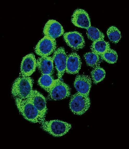Anti-ATXN1 (S776) Antibody