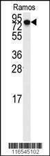 Anti-DLG7 (N-term) Antibody