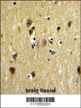 Anti-STIP1 (Center) Antibody