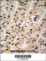 Anti-PCNA (C-term) Antibody