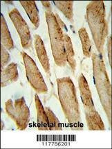 Anti-POLG2 (C-term) Antibody