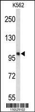 Anti-HSPH1 (Center) Antibody