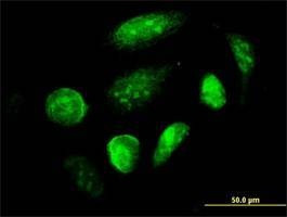 Anti-GCM1 Antibody