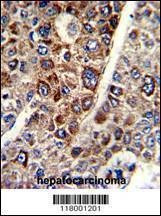 Anti-CD38 (C-term) Antibody