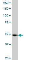 Anti-GCN5L2 Antibody