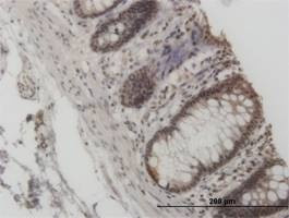 Anti-GCN5L2 Antibody