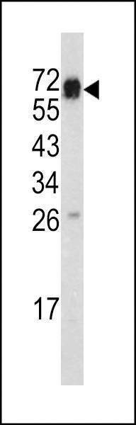 Anti-CD105 (Center E395) Antibody