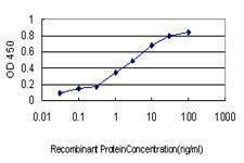 Anti-GCSH Antibody