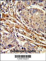 Anti-APRT (C-term) Antibody
