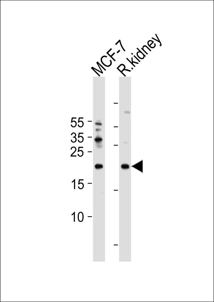 Anti-APRT (C-term) Antibody
