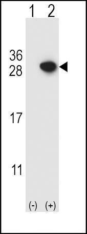 Anti-ARHGDIA (C-term) Antibody