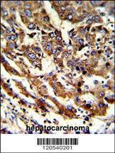 Anti-ERP29 (Center) Antibody