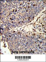 Anti-CFL1 (N-term) Antibody