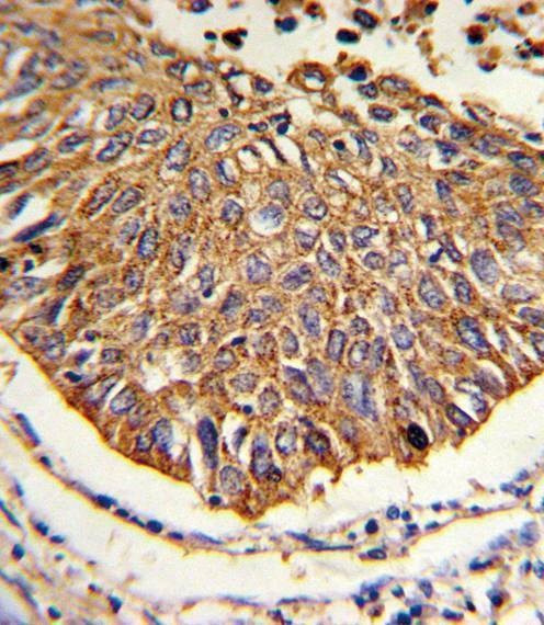 Anti-MDH2 (Center) Antibody