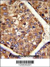 Anti-P4HB (C-term) Antibody