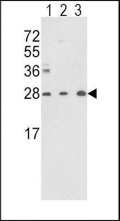 Anti-TPI1 (N-term) Antibody